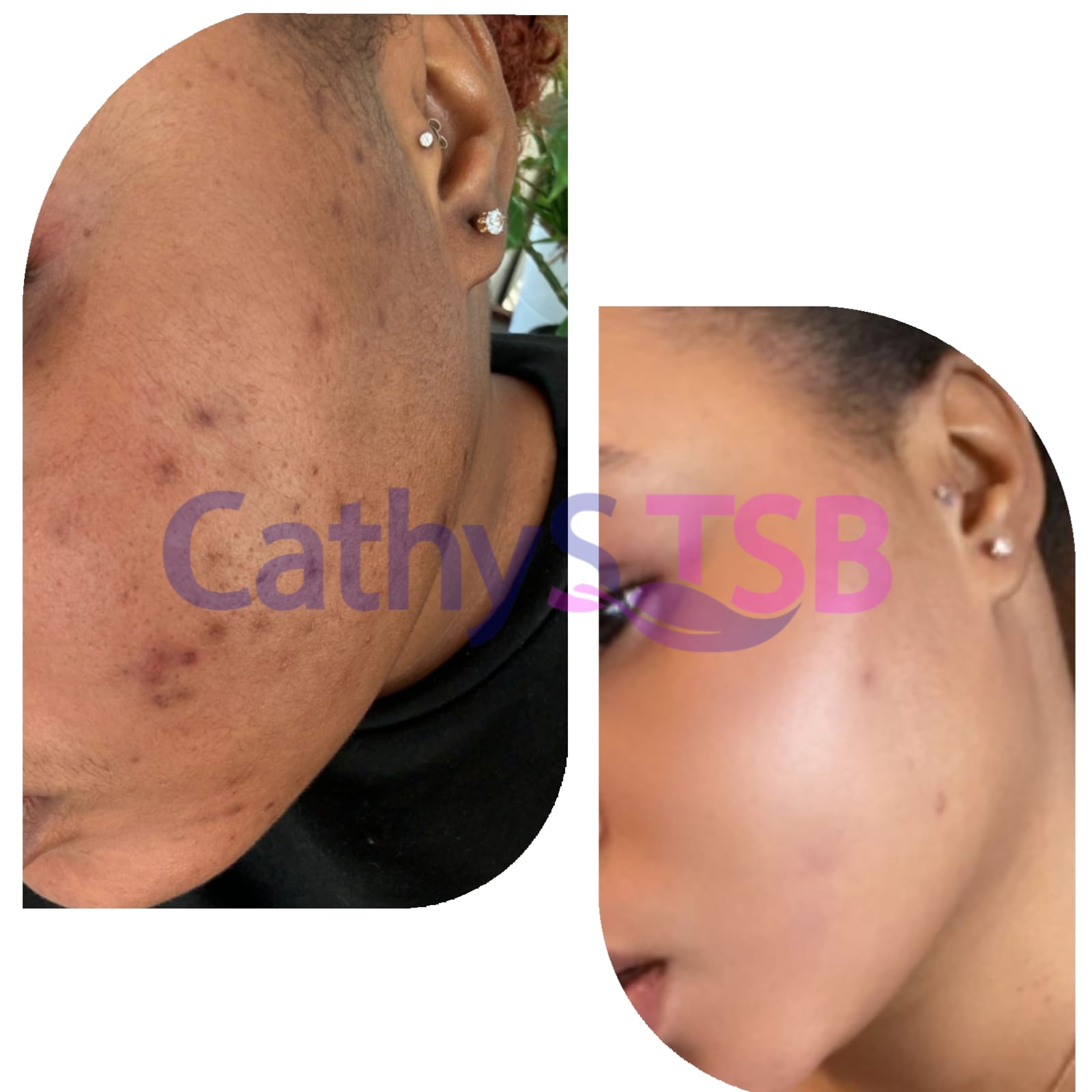 Carrot Brightening Cream, Anti-Aging, Hydrating Skin Unify ( 27.1 Fl Oz 770ml)