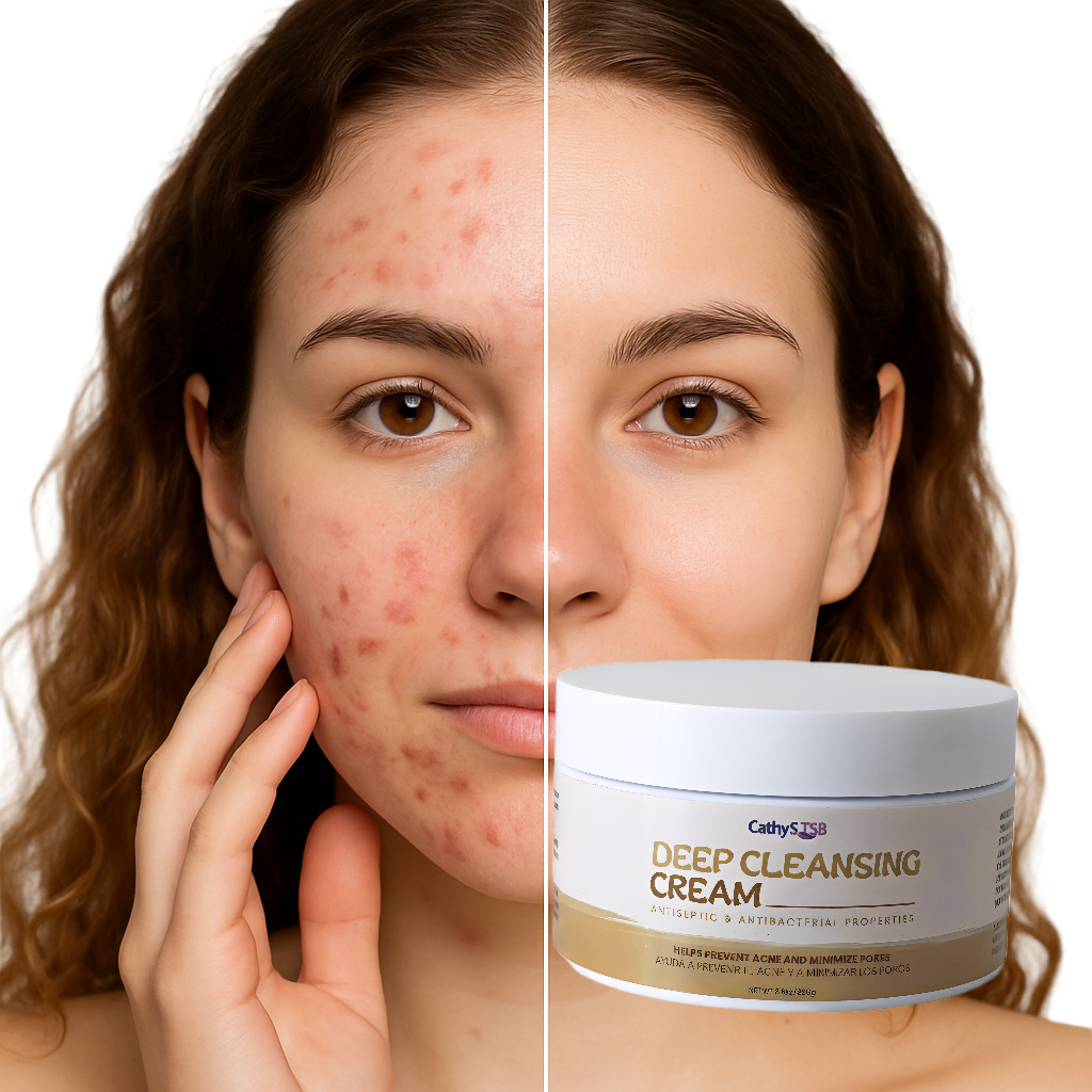 Deep Cleansing Face Wash Anti Acne, Hydrating 8.8oz